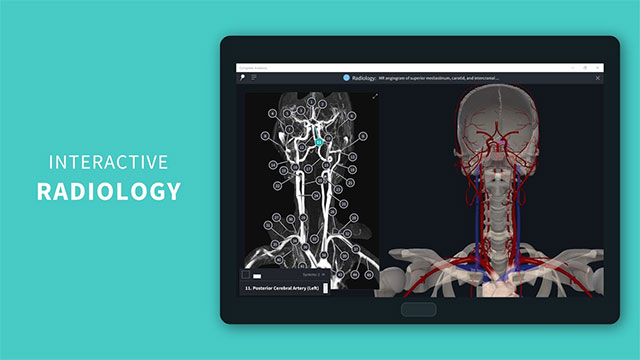 Complete Anatomy 2021 continuously updates the calculator. new features, improvements and bug fixes